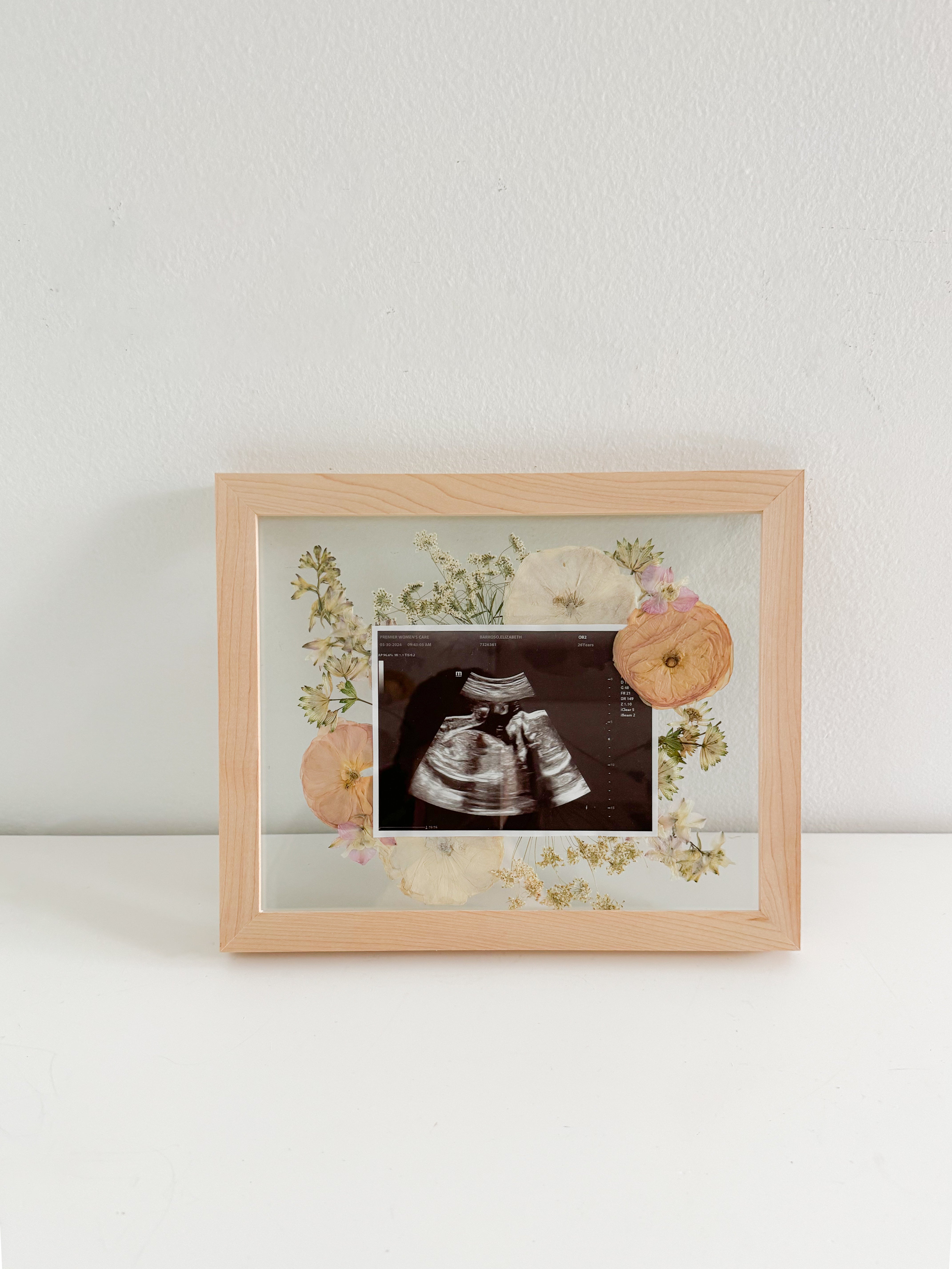 sonogram frame