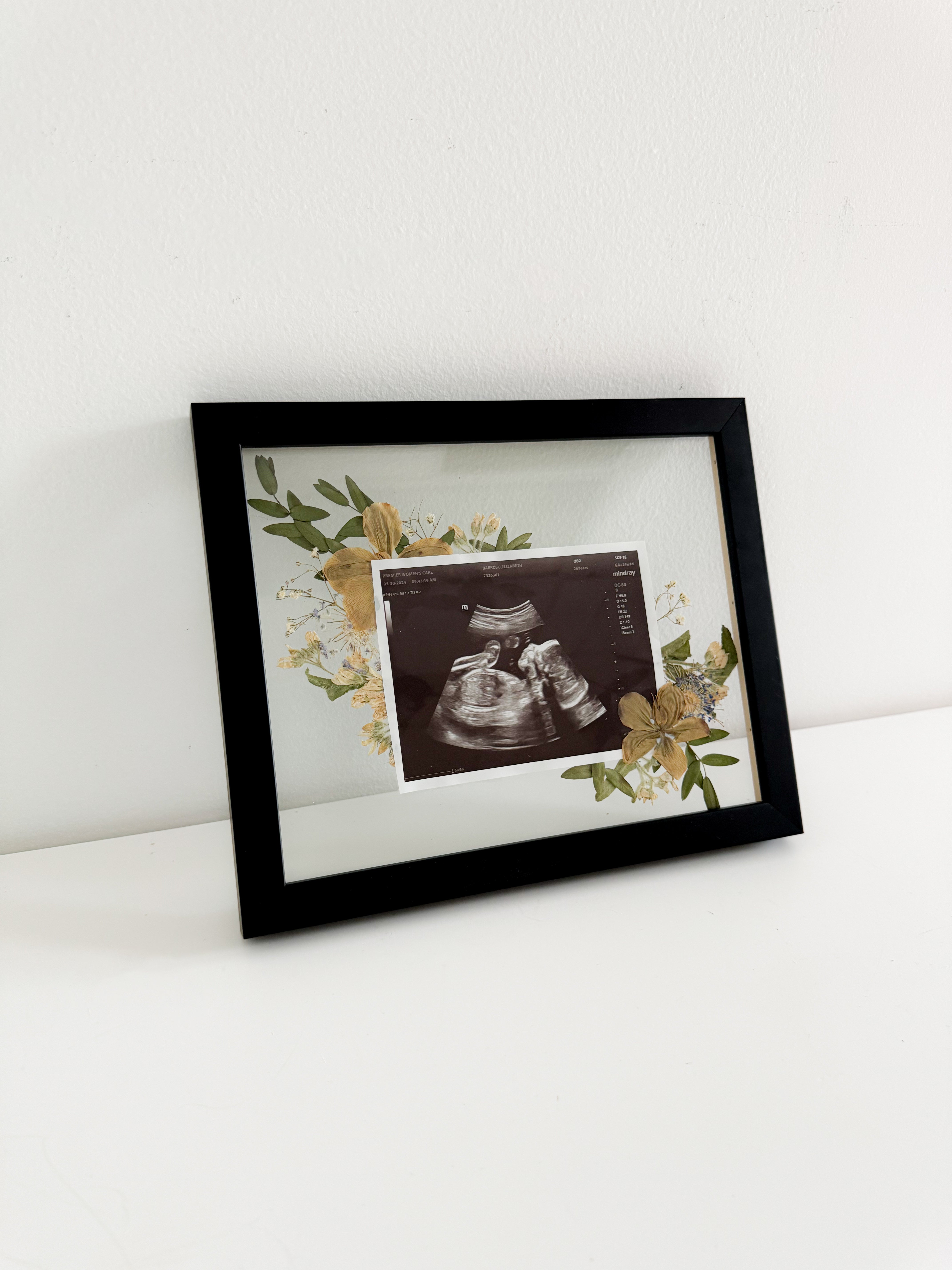 Sonogram Frame