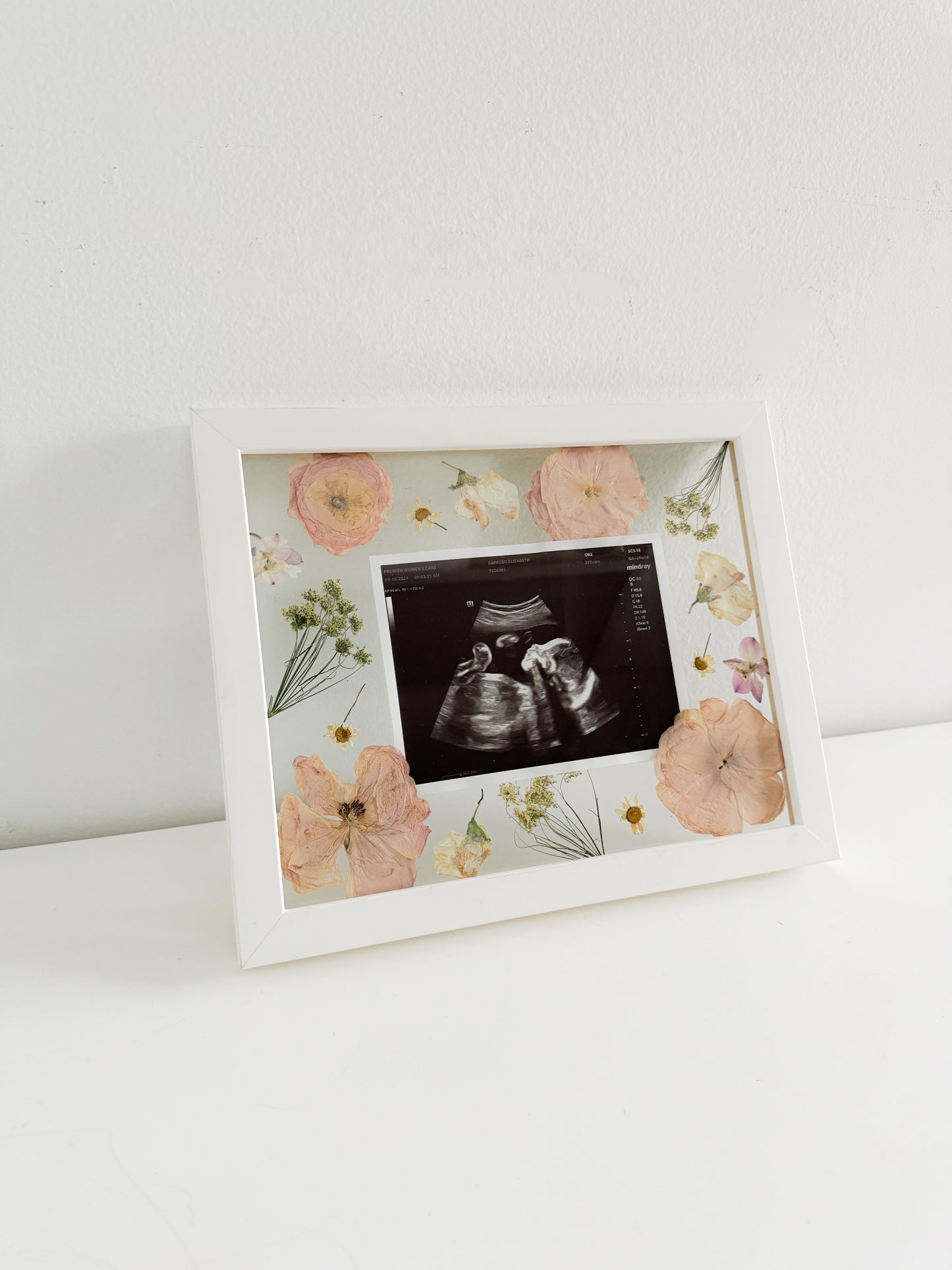 baby sonogram preservation